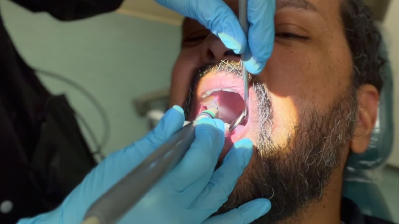 una vista de cerca de un hombre de mediana edad con barba en el dentista