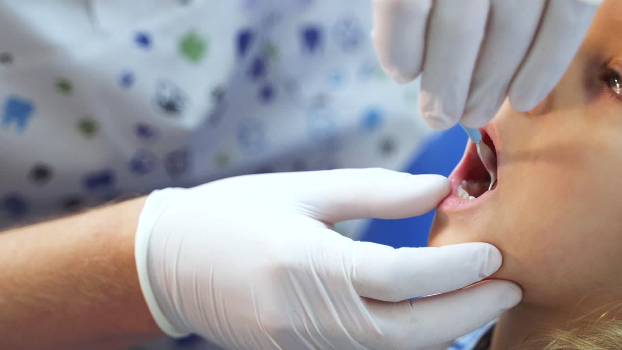 Dental examination of the child. Doctor's hands in medical gloves with a dental tool. Little girl opens her mouth