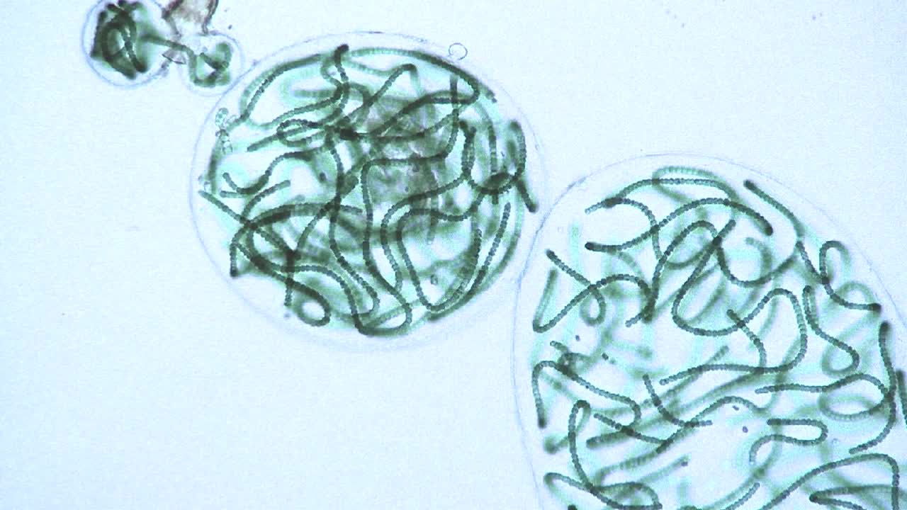 vista microscópica de sacos o burbujas que contienen cadenas de algas verdes azules 1