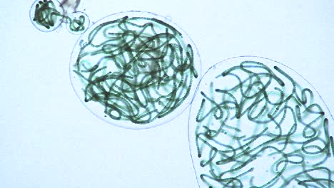 microscopic view of sacks or bubbles containing chains of blue green algae 1