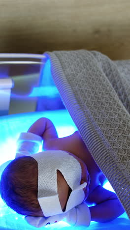 baby under phototherapy