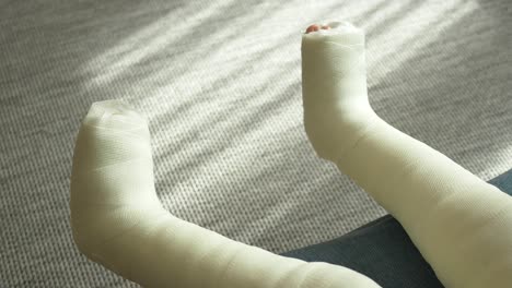 child with a broken leg in a cast