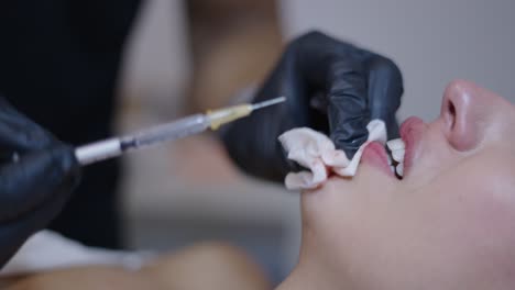 lip filler injection procedure
