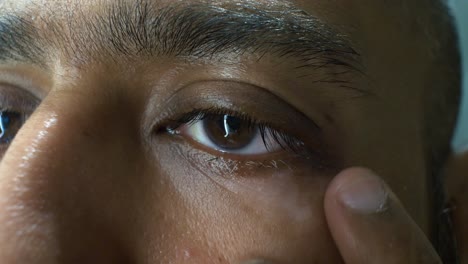 southeast asian indian man looking for vitiligo around eye lids