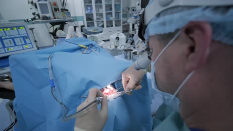 operation of removing tonsils under deep anesthesia, surgeon uses latest devices, cold plasma method, cuts swelling in throat, doctor works with new probe, medical headlamp, surgical loupes