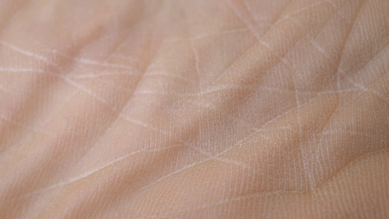 Close-up of human palm skin texture