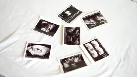 ultrasound photo on the bed. concept of waiting for the birth of a baby