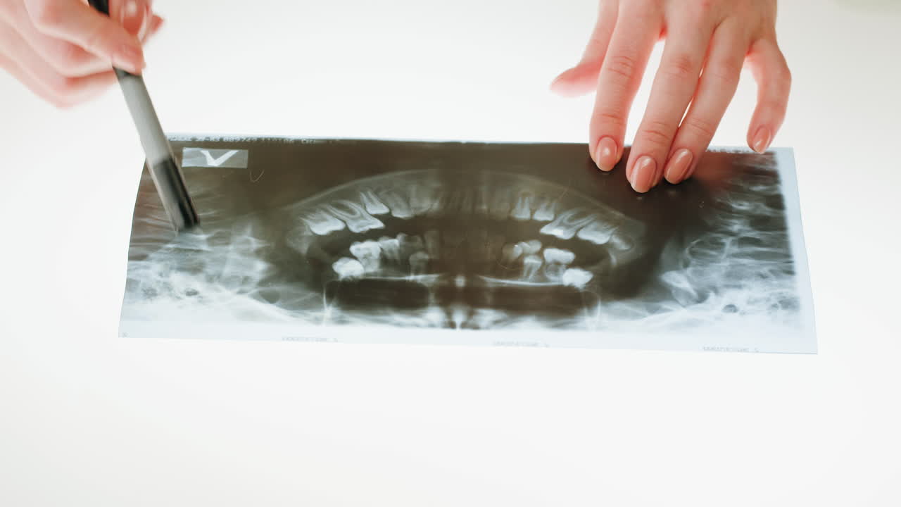 Person Examining a Panoramic Dental X-ray
