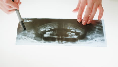 person examining a panoramic dental x-ray