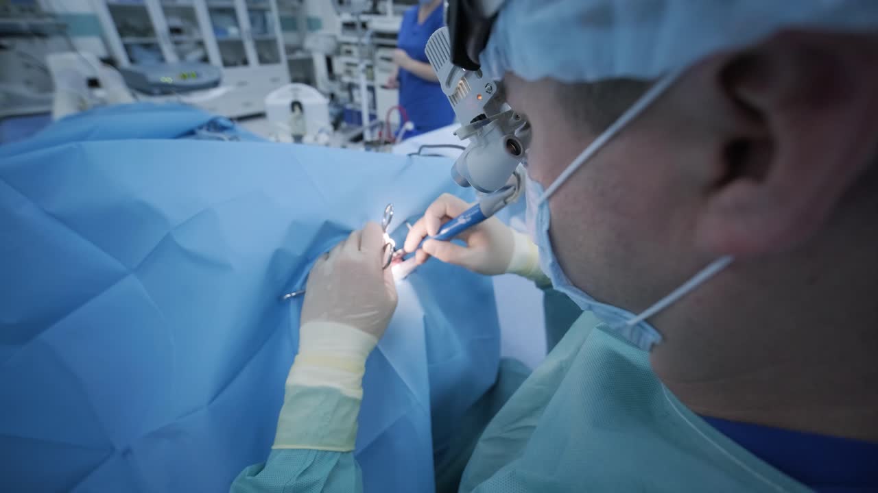 operación de extirpación de amígdalas. amigdalectomía bajo anestesia profunda, utilizando los últimos dispositivos, método de plasma frío, cortes hinchazón en la garganta, el médico trabaja con una nueva sonda, lámpara frontal médica, lupas quirúrgicas