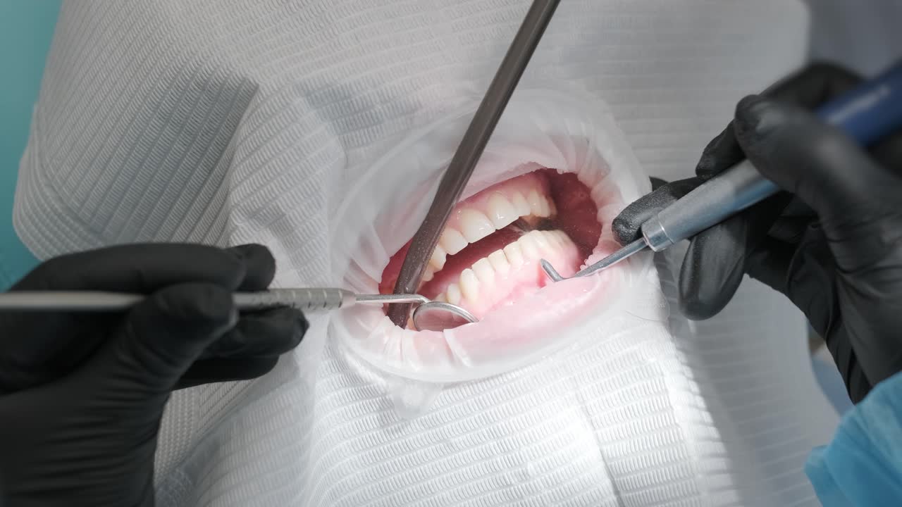 치아를 게 하는 제일 (gel) 이란 치아 게 만드는 제일 (gels) 이란 이빨을 게하는 제일 (whitening gel) 이란