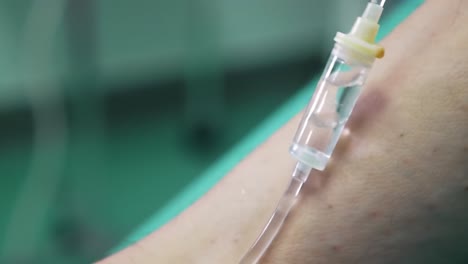 close-up of an arm with an intravenous drip, reflecting the medical care being administered in a hospital. the setting emphasizes patient comfort and monitoring during treatment.