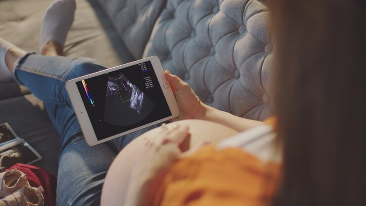Pregnant Woman Viewing Ultrasound Scan