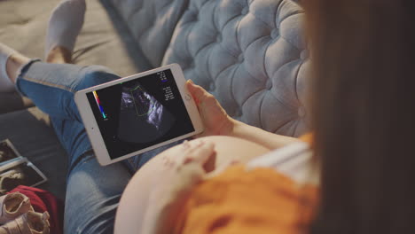 pregnant woman viewing ultrasound scan