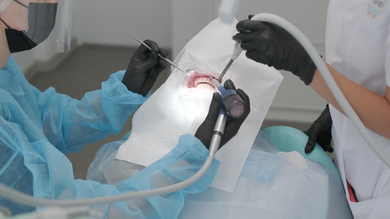 procedimiento de blanqueo de dientes. gel blanqueador de dientes. el dentista hace el procedimiento de blankeo