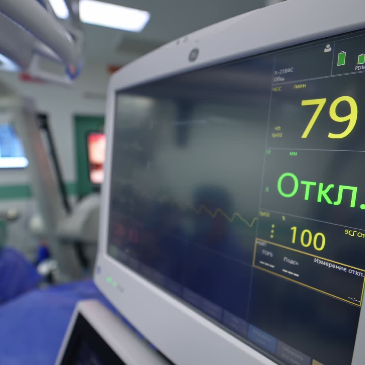 Couple of screens are on in the modern surgery room. Black monitor with patient's life signs. Surgery at process at backdrop in blur