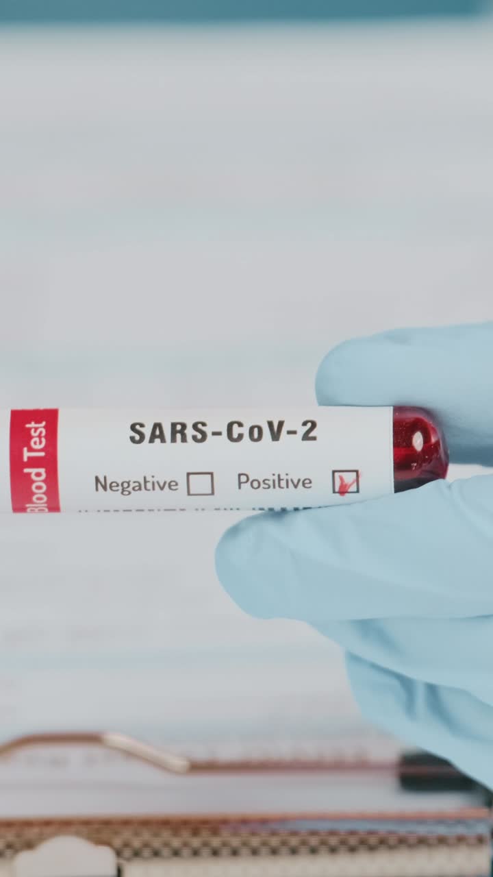 Un medico esegue un esame del sangue con una provetta SARS-CoV-2 in un moderno laboratorio.