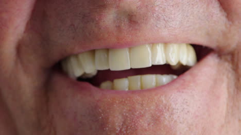 closeup of laughing man showing teeth