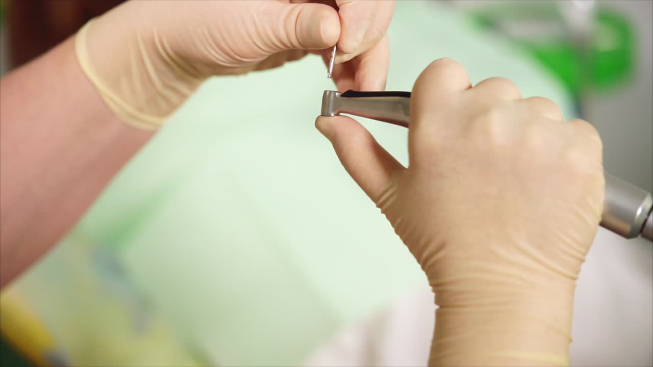 Dental procedure: attaching a drill bit