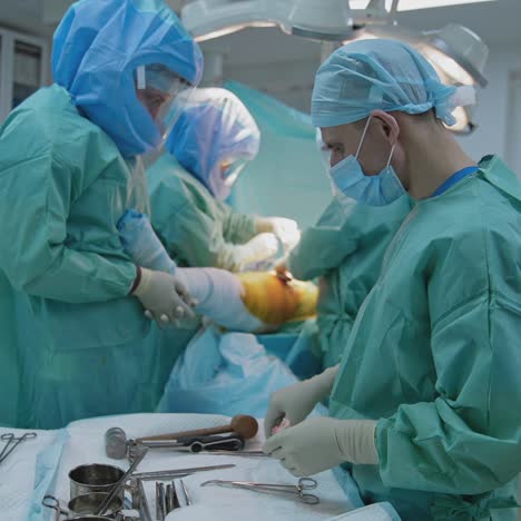 group of surgeons in protective uniform. male assistant gives sterile instruments to the professional surgeons during operation on leg. pandemic in the world
