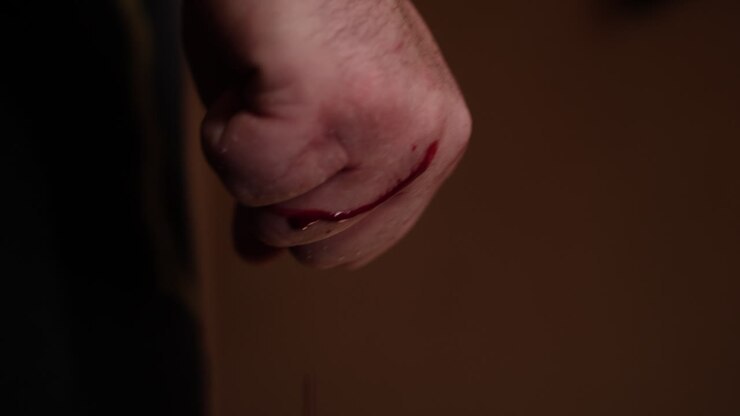 Clenched fist with blood on it