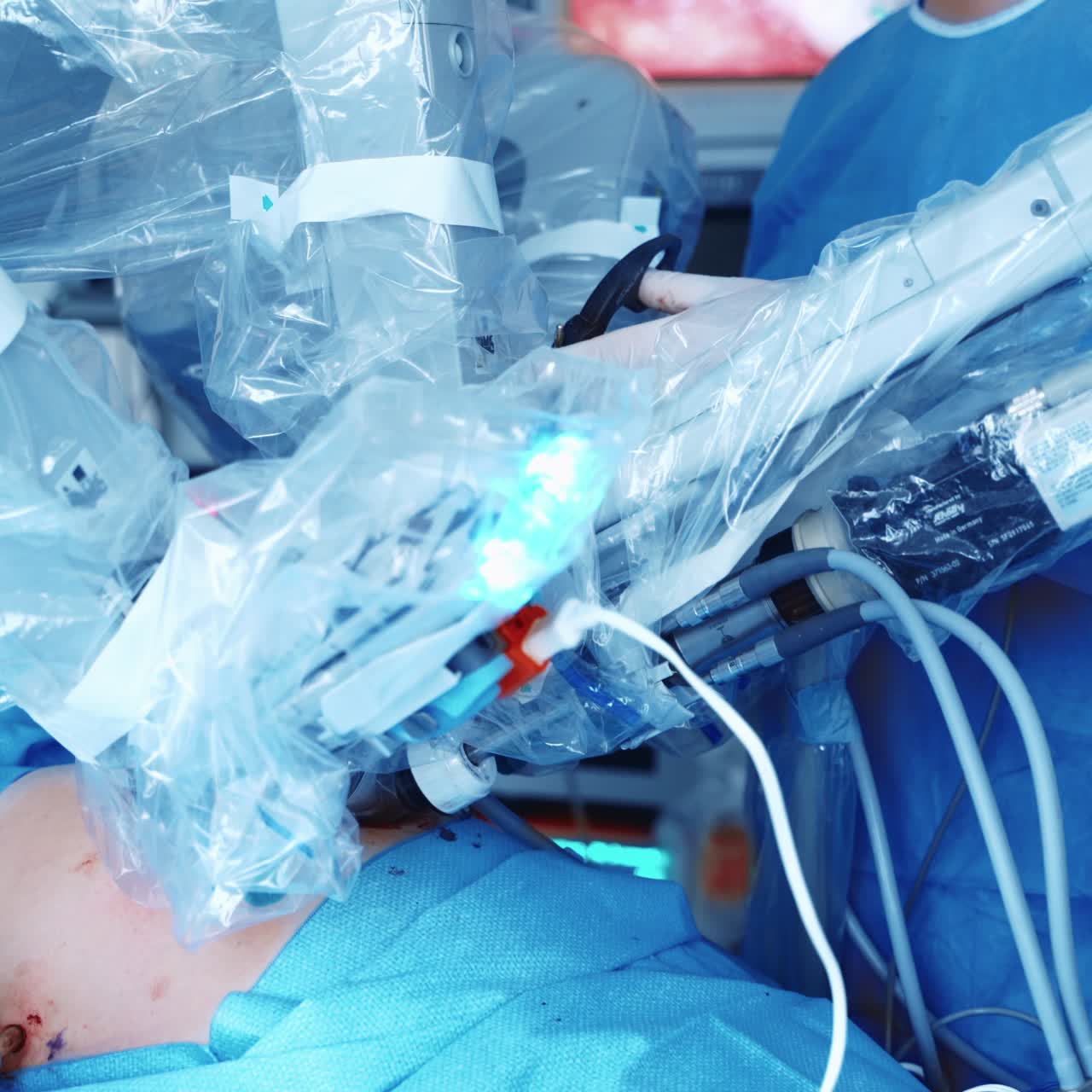 Innovative medical equipment during surgery. Medical robot performing an operation on a patient. Surgeon near robotic machine in clinic. Close-up.