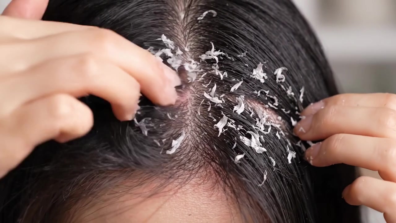 A Close-Up Look at Scalp Treatment Application: Observing the Process of Hair Care Through Product Distribution and Its Effects on the Hair and Scalp