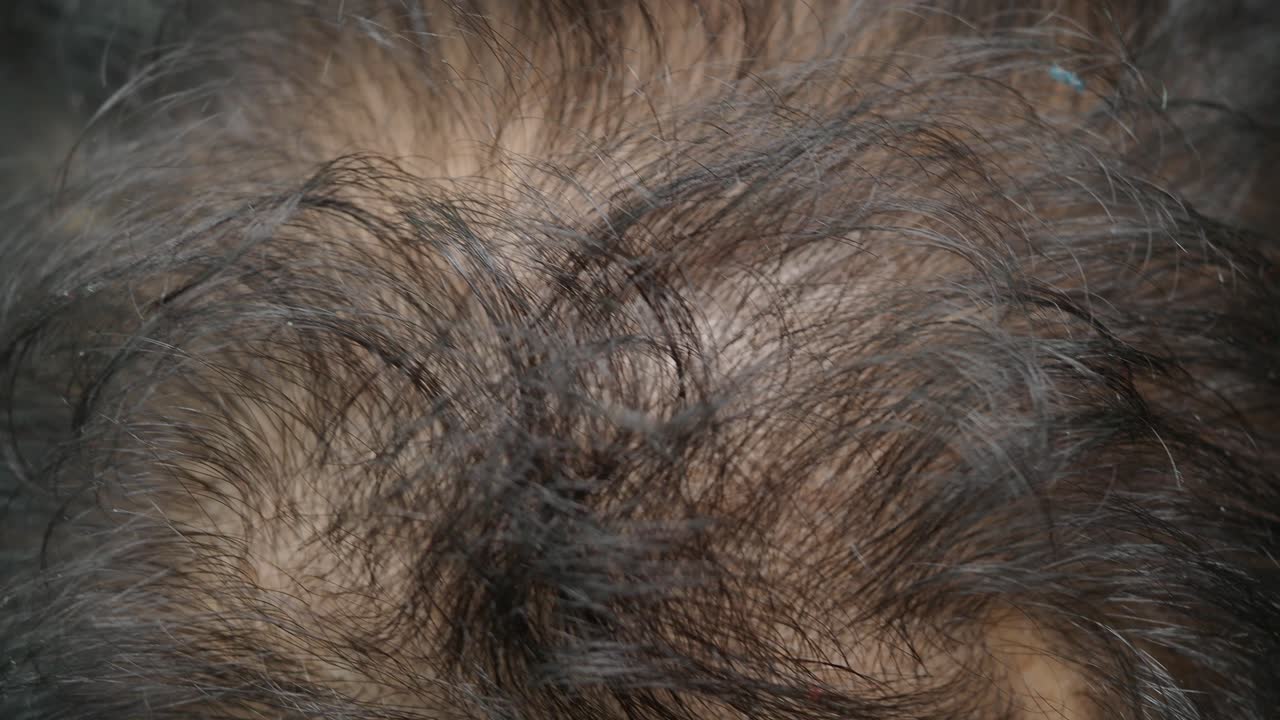 Close-up of a person's scalp and hair