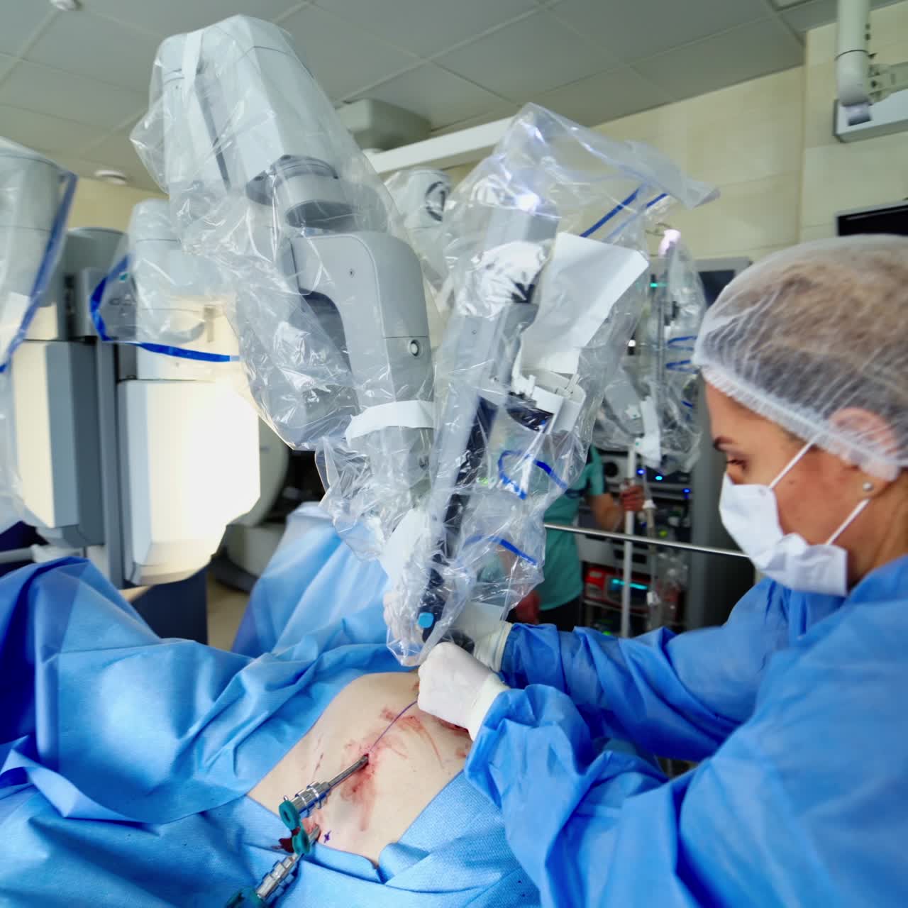 Modern surgical system. Medical robot. Minimally invasive robotic surgery. Da Vinci Surgery