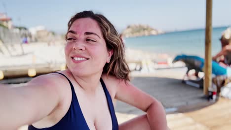 real summer body: woman with sunburn at the coast