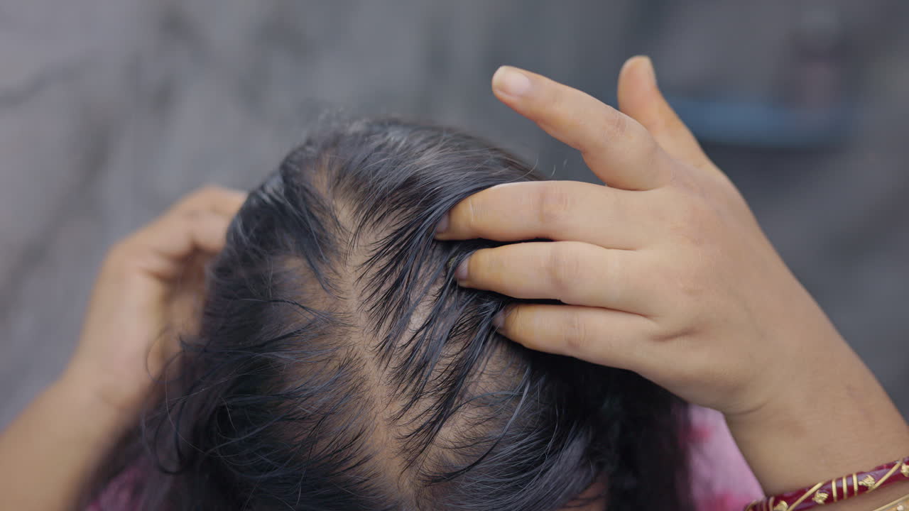 A woman showing her bald patches and thinning hair in indoor setting