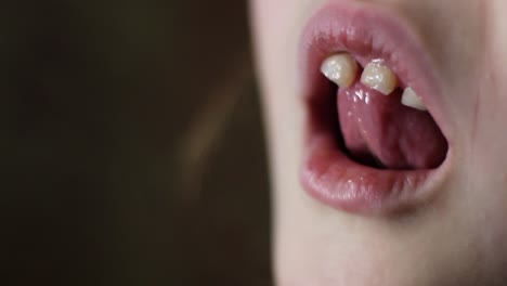 close up of young girl wiggling loose front teeth with tongue