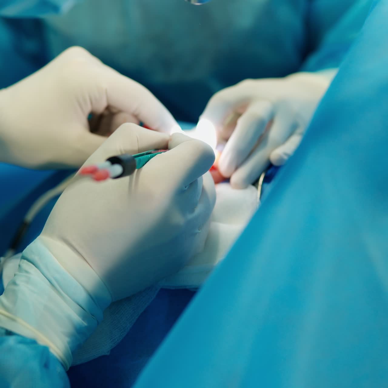 Hands of a doctor and a nurse in sterile gloves. Surgeons hands holding medical equipment during the operating process. Close-up.