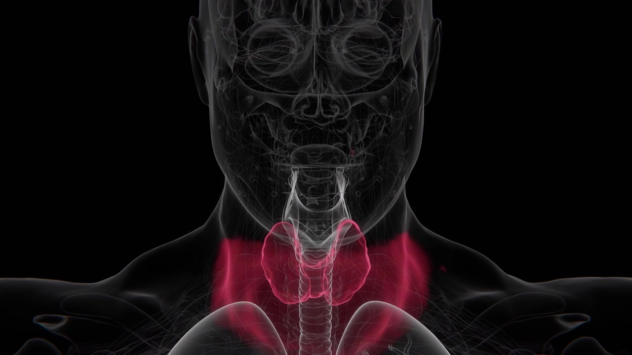 Il gozzo è un ingrossamento della ghiandola tiroidea che può verificarsi a causa di disfunzione tiroidea, carenza di iodio, condizioni autoimmuni o altre cause sottostanti in video 4K.