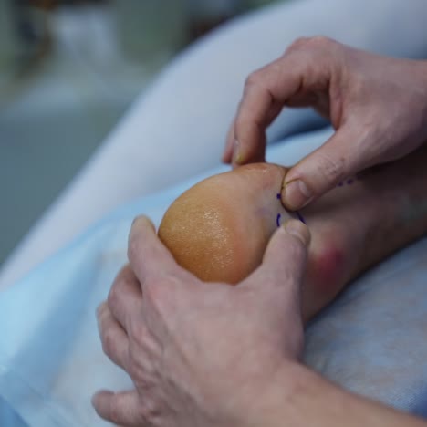 process of trauma surgery operation