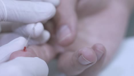 análisis de sangre de los dedos. toma de muestras de sangre de los dedos. extracción de muestras de sangre