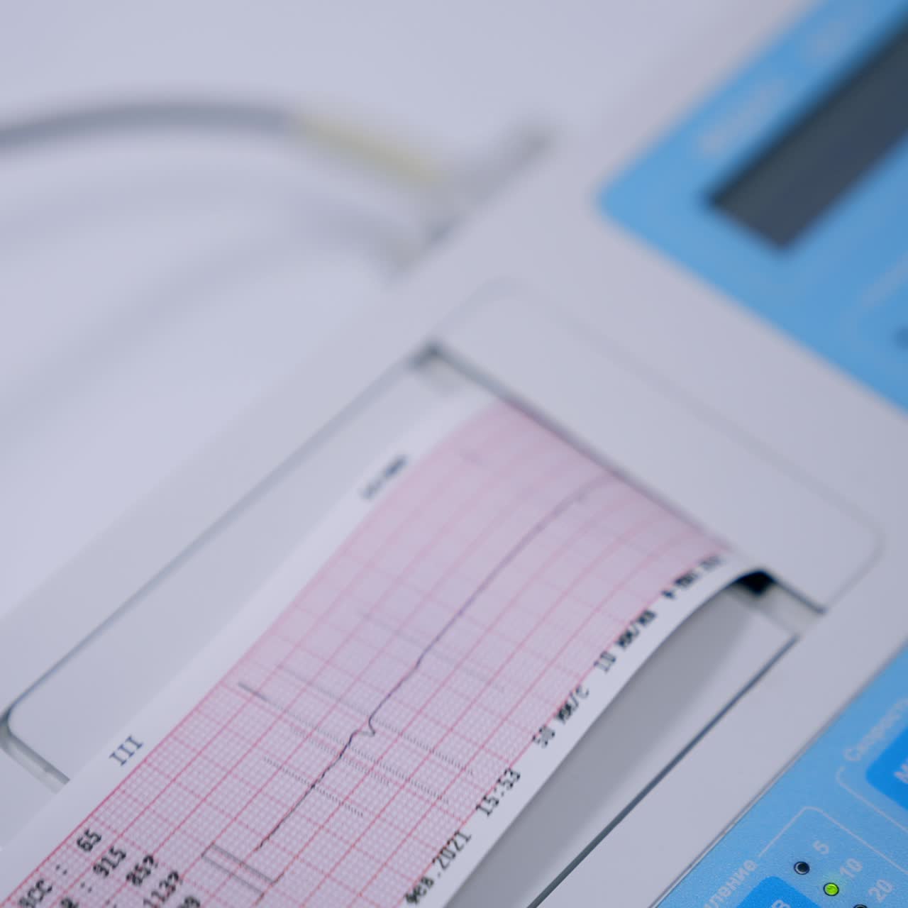 Elektrokardiogrammin tarkastus klinikalla. Elektrokardiografilaite tulostaa paperille sydämenlyöntikäyrän. Lähikuva