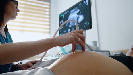 prenatal ultrasound procedure