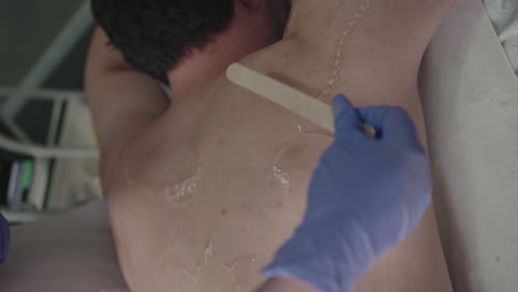 applying gel on man's back before laser hair removal - vertical video
