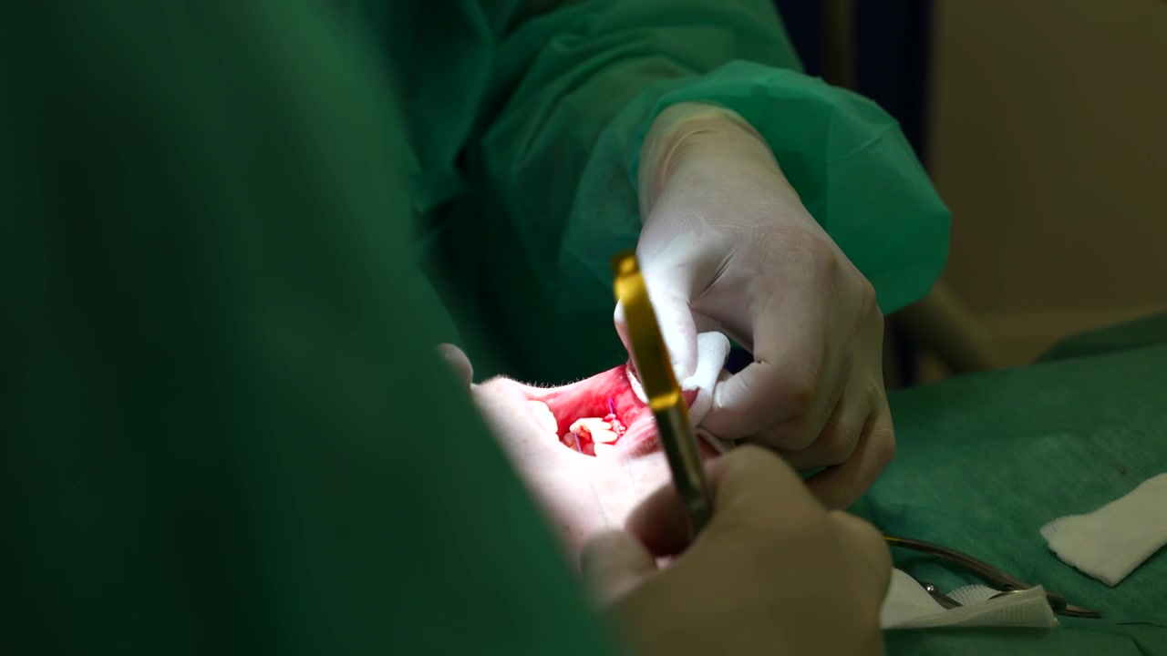Dental procedure with close-up of tweezers sewing gum graft in clinic