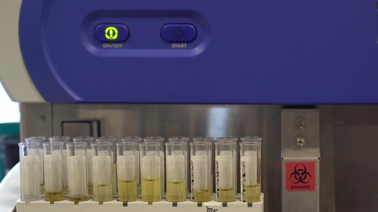 A clinical analysis lab machine with test tubes filled with samples for medical testing