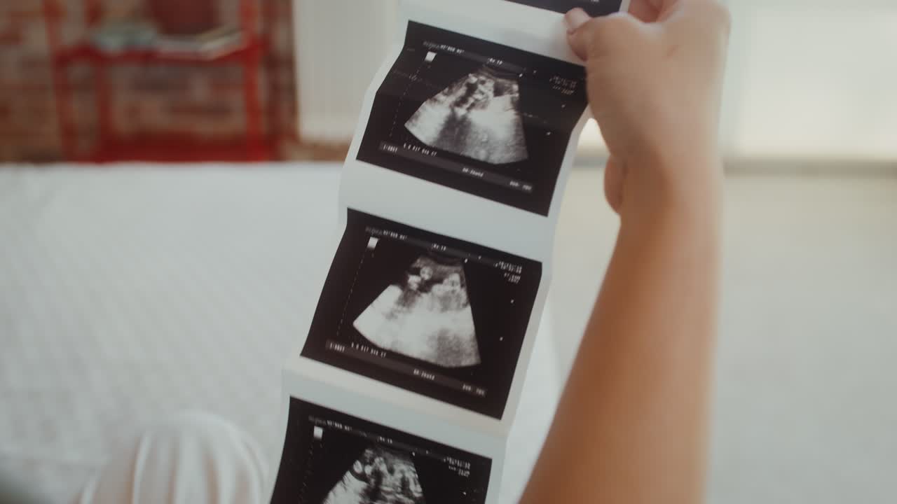 Donna che guarda immagini ecografiche