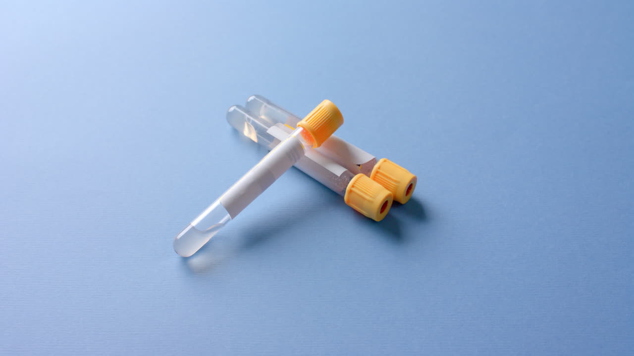 파란색 배경에 있는 혈액  ⁇ 플의 클로즈업, 복사 공간, 슬로우 모션