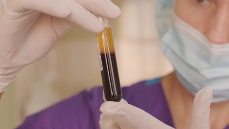 platelet-rich plasma preparation. tube with blood in hands.