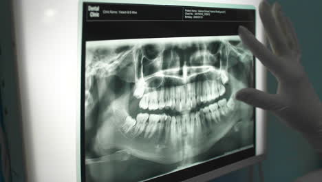 Dentist-Examining-Teeth-with-X-Ray-Plates