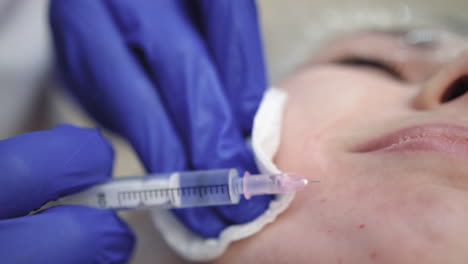procedimiento de inyección facial