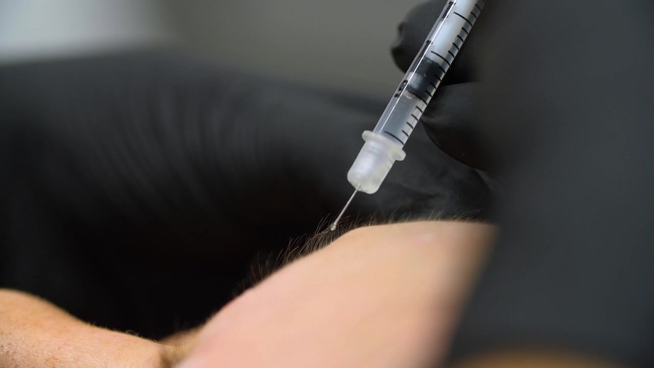 Iniezione di Botox da parte di un'estetista con una siringa nella fronte di una donna. Primo piano