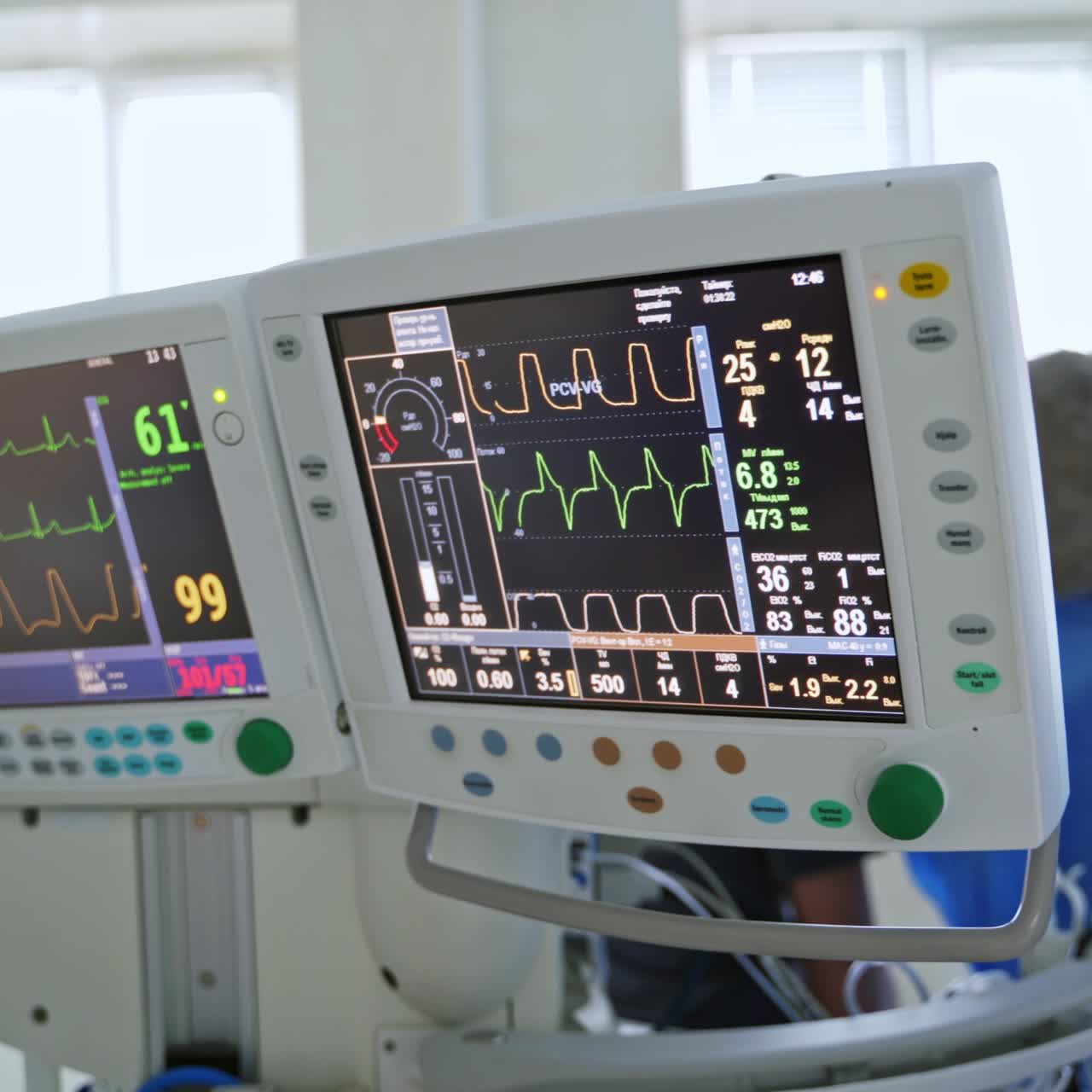 Medical equipment in the operating room. Modern monitors show the heartbeat and pulse of a patient during the operation. Healthcare concept.