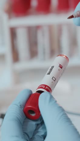 healthcare professional examines blood test tube in clinical laboratory setting