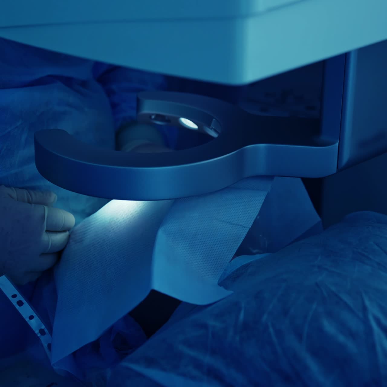 Eye surgery in the operating room. Eye-surgeon operating patient through laser vision correction machine. Close-up. Blue light